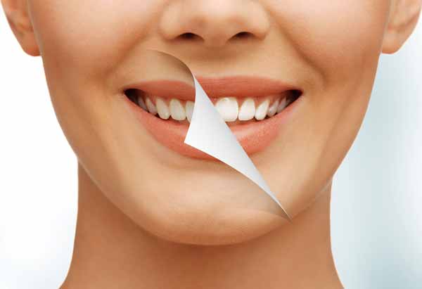 Dental Whitening North Vancouver