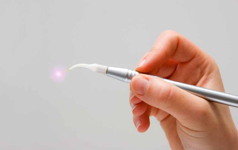 Pain Free Dentistry in North Vancouver