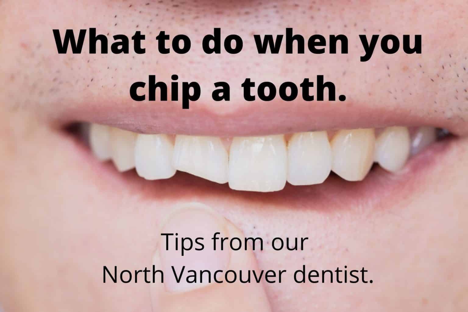 Chipped Tooth? Act Fast to Minimize Your Treatment Needs - Pier Dental