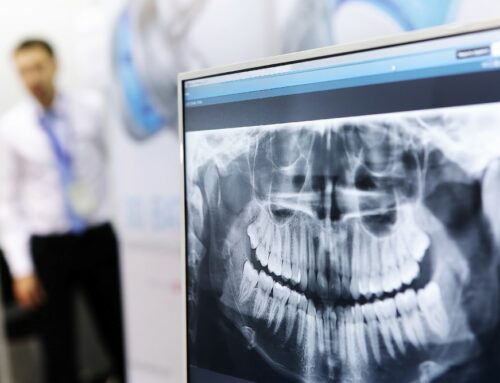 How Often Should I Visit the Dentist?