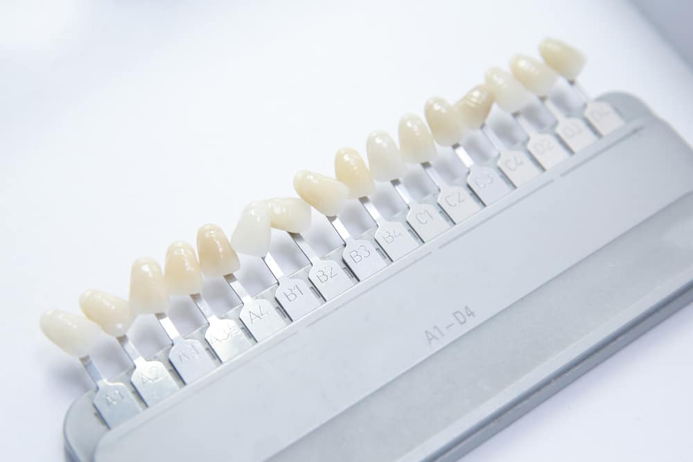 the right veneers for you