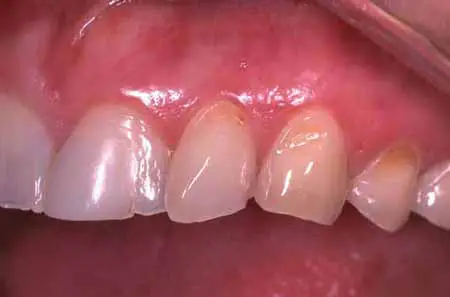 Restorative Dentistry dental case