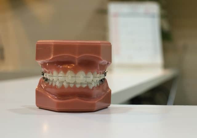 white teeth denture checkup