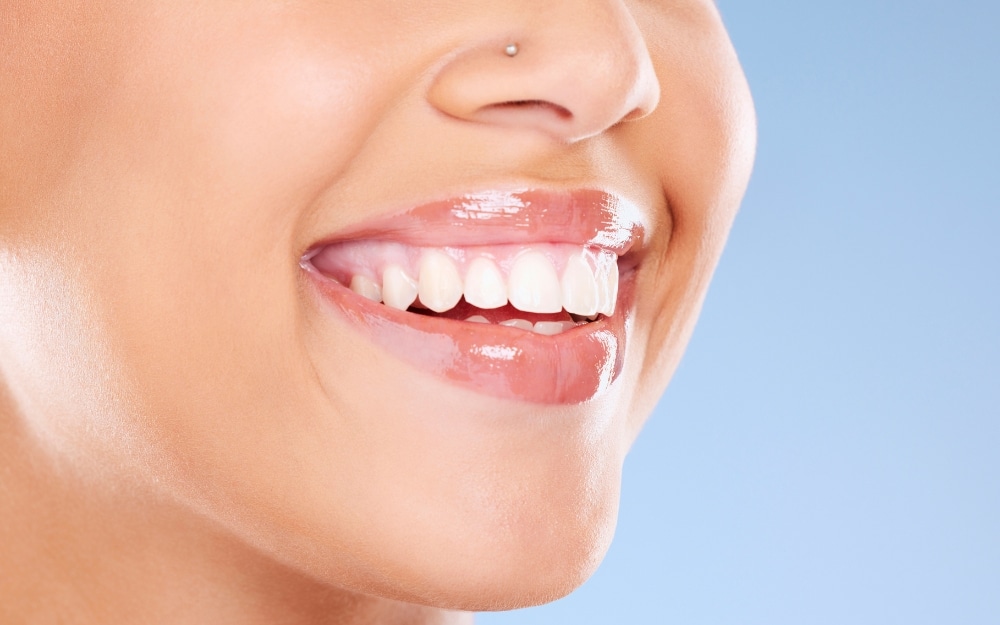 Home-based teeth whitening