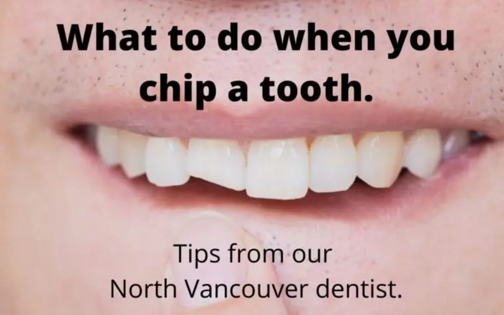 What-to-do-when-you-chip-a-tooth