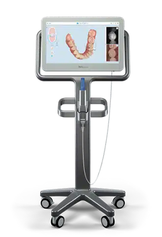 A picture of an iTero Intraoral Scanner