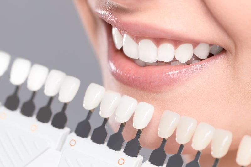 Dental Bridges benefits